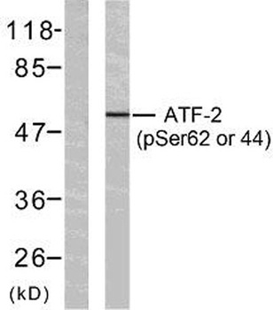 ATF-2 (phospho Ser62) rabbit pAb Antibody
