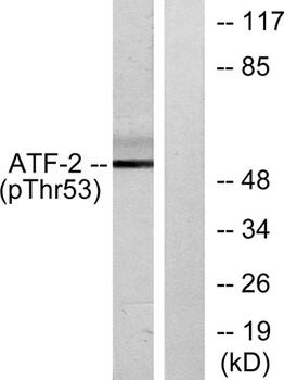 ATF-2 (phospho Thr71) rabbit pAb Antibody