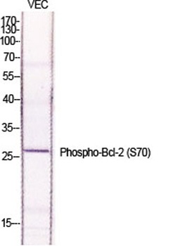Bcl-2 (phospho Ser70) rabbit pAb Antibody