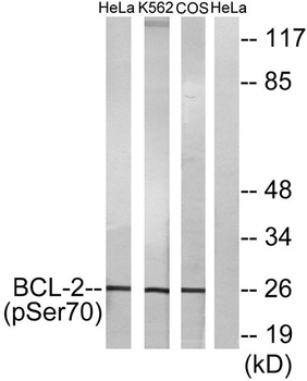 Bcl-2 (phospho Ser70) rabbit pAb Antibody