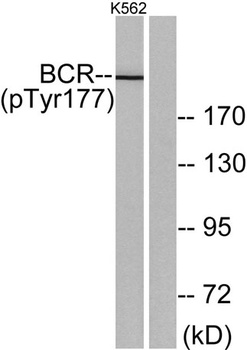 Bcr (phospho Tyr177) rabbit pAb Antibody