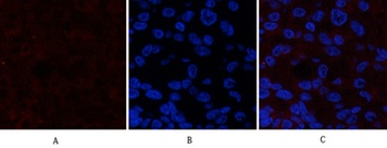 Catenin-β (phospho Ser37) rabbit pAb Antibody