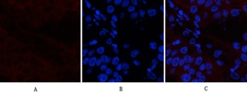 Catenin-β (phospho Ser37) rabbit pAb Antibody
