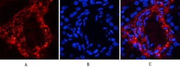 Catenin-β (phospho Ser37) rabbit pAb Antibody