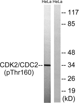 Cdc2 (phospho Thr161) rabbit pAb