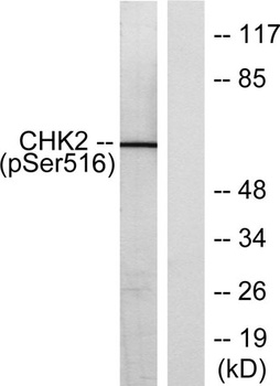 Chk2 (phospho Ser516) rabbit pAb Antibody