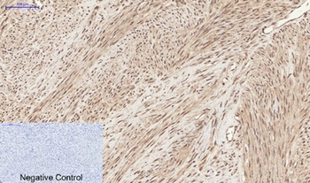 Chk2 (phospho Thr68) rabbit pAb Antibody