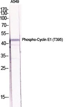 Cyclin E1 (phospho Thr395) rabbit pAb Antibody