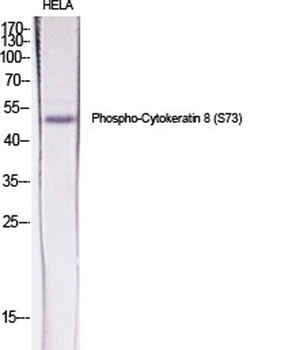 Cytokeratin 8 (phospho Ser73) rabbit pAb Antibody