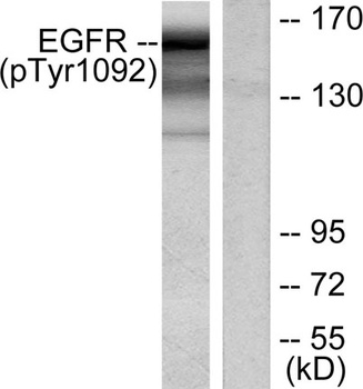 EGFR (phospho Tyr1092) rabbit pAb