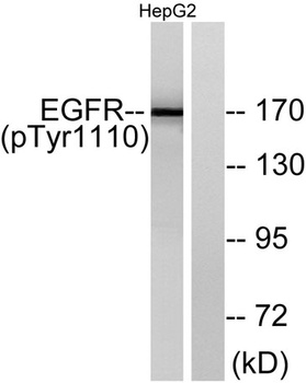 EGFR (phospho Tyr1110) rabbit pAb Antibody