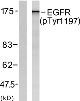 EGFR (phospho Tyr1197) rabbit pAb