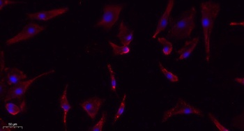 eIF2α (phospho Ser51) rabbit pAb Antibody
