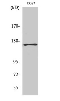 FAK (phospho Tyr861) rabbit pAb Antibody