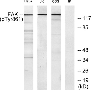 FAK (phospho Tyr861) rabbit pAb Antibody