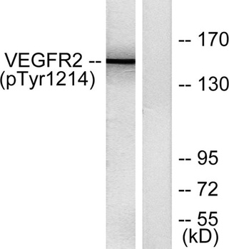 Flk-1/VEGFR2 (phospho Tyr1214) rabbit pAb