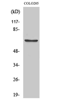 FoxO4 (phospho Ser197) rabbit pAb Antibody