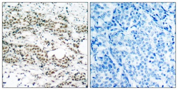 FoxO4 (phospho Ser197) rabbit pAb Antibody