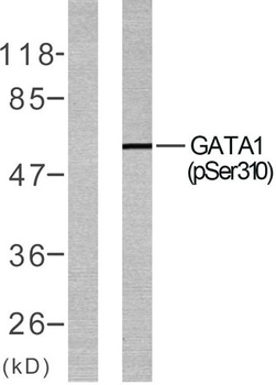 GATA-1 (phospho Ser310) rabbit pAb Antibody