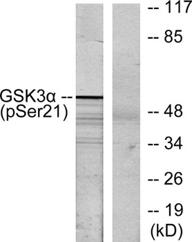 GSK3α (phospho Ser21) rabbit pAb Antibody