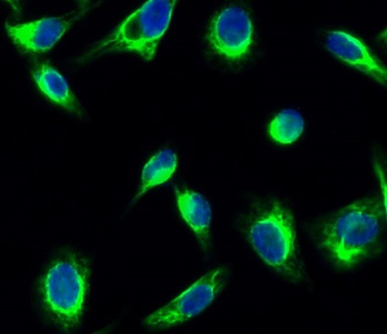 GSK3α/β (phospho Tyr279/216) rabbit pAb Antibody