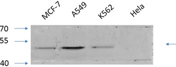 GSK3α/β (phospho Tyr279/216) rabbit pAb Antibody