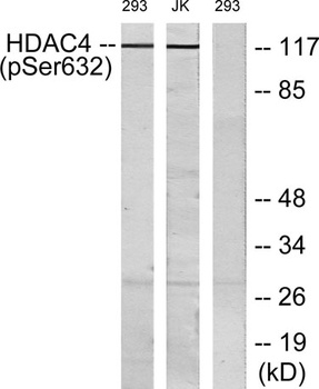 HDAC4 (phospho Ser632) rabbit pAb Antibody