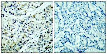 HDAC5 (phospho Ser498) rabbit pAb Antibody
