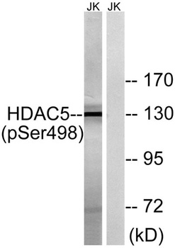 HDAC5 (phospho Ser498) rabbit pAb Antibody