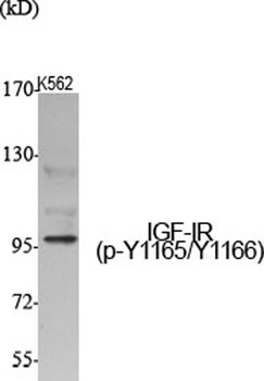 IGF-IR (phospho Tyr1165/Y1166) rabbit pAb Antibody