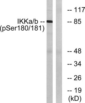 IKKα/β (phospho Ser180/181) rabbit pAb Antibody