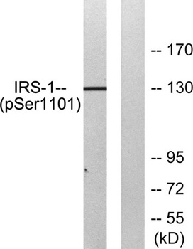 IRS-1 (phospho Ser1101) rabbit pAb Antibody