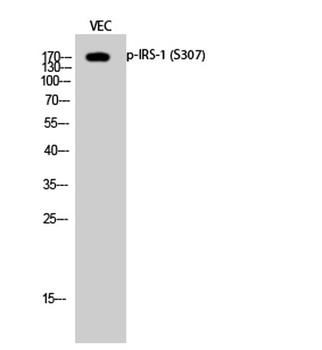 IRS-1 (phospho Ser307) rabbit pAb Antibody