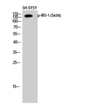 IRS-1 (phospho Ser636) rabbit pAb Antibody