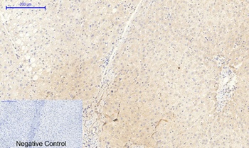 JAK2 (phospho Tyr1007) rabbit pAb