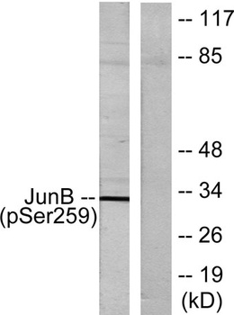 Jun B (phospho Ser259) rabbit pAb