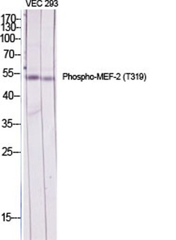 MEF-2 (phospho Thr319) rabbit pAb Antibody