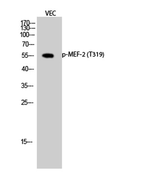 MEF-2 (phospho Thr319) rabbit pAb Antibody