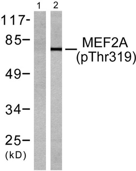 MEF-2 (phospho Thr319) rabbit pAb Antibody