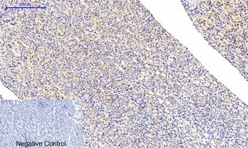 MEK-1/2 (phospho Ser218/222) rabbit pAb Antibody