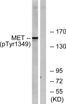 Met (phospho Tyr1349) rabbit pAb Antibody
