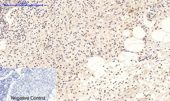 NFκB-p65 (phospho Ser276) rabbit pAb Antibody