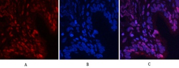 NFκB-p65 (phospho Ser529) rabbit pAb Antibody