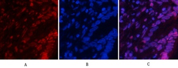 NFκB-p65 (phospho Ser529) rabbit pAb Antibody