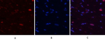 NFκB-p65 (phospho Ser529) rabbit pAb Antibody