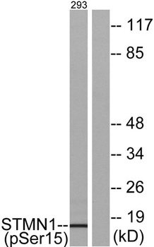 Op18 (phospho Ser16) rabbit pAb Antibody