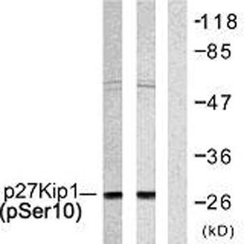 p27 (phospho Ser10) rabbit pAb Antibody