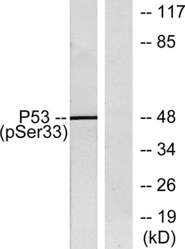 p53 (phospho Ser33) rabbit pAb Antibody