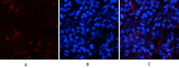 p53 (phospho Thr18) rabbit pAb Antibody