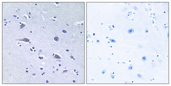 p70 S6 kinase α (phospho Thr229) rabbit pAb Antibody